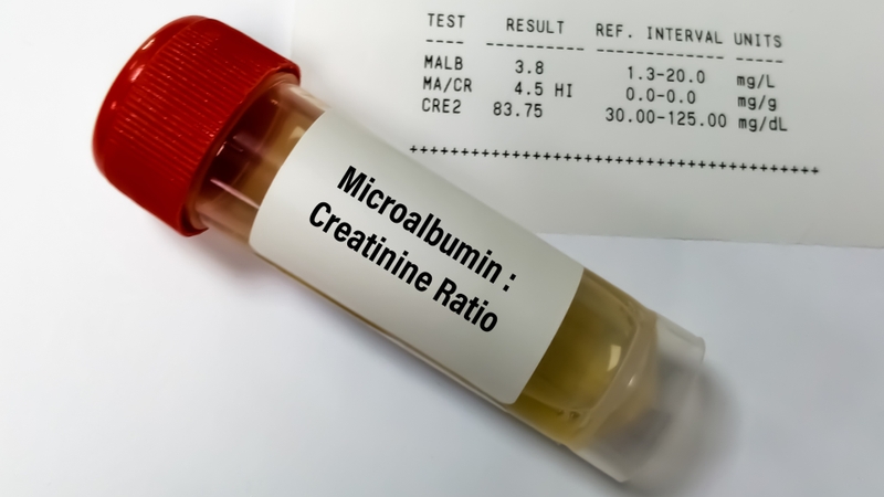 Chỉ số albumin trong nước tiểu cao: Dấu hiệu cảnh báo sớm các bệnh lý nguy hiểm 4