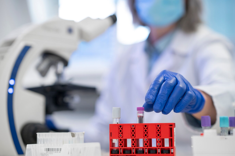 Chỉ số amh là gì? Xét nghiệm amh ở đâu? 3