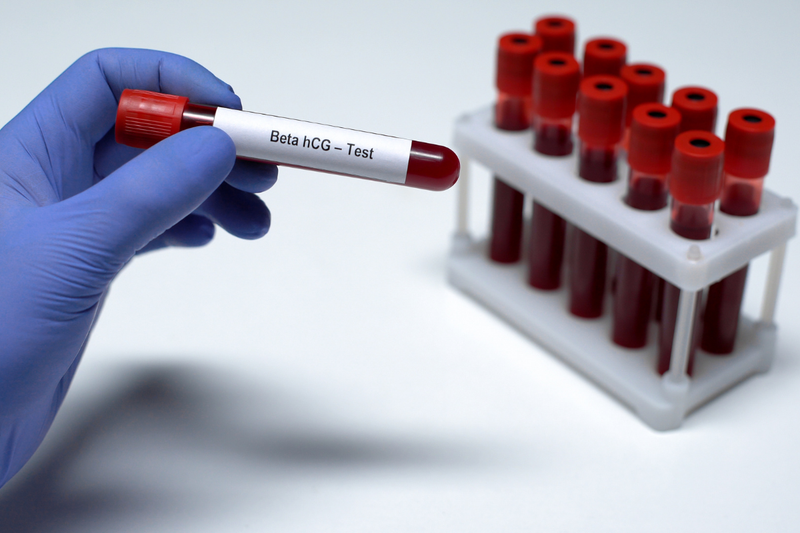 chi-so-beta-h-cg-thai-ngoai-tu-cung-nhung-dieu-ban-can-biet 1.png