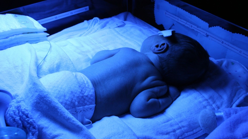 Chiếu đèn là phương pháp điều trị vàng da sơ sinh hiệu quả và an toàn