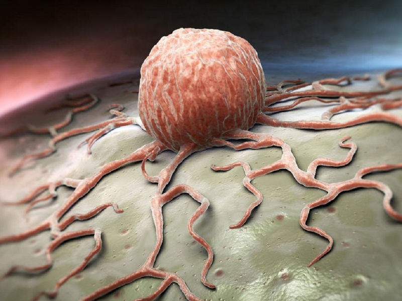 Chỉ số CEA trong máu bao nhiêu là bình thường 3