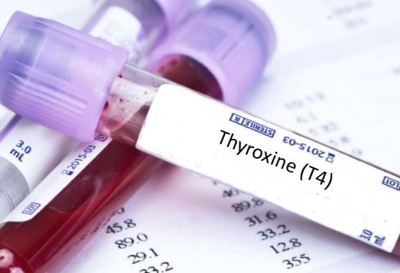 Chỉ số ft4 giảm khi mang thai và những điều cần biết 1