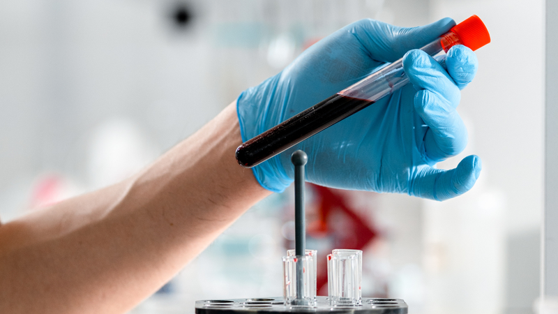 Chỉ số giun sán trong xét nghiệm máu còn giúp bác sĩ chẩn đoán và đưa ra phác đồ điều trị chính xác