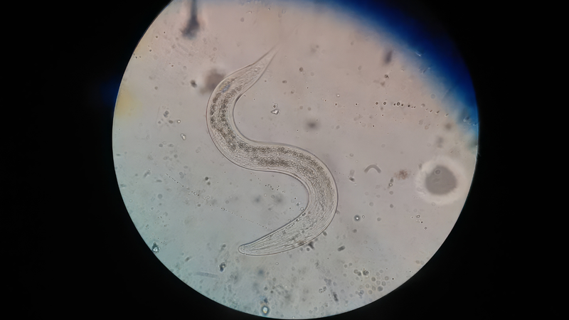 Chỉ số giun sán trong xét nghiệm máu là gì?