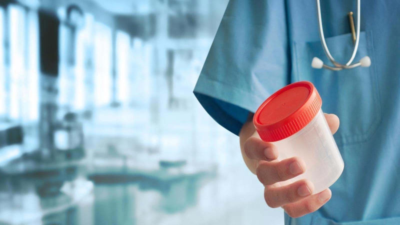 Chỉ số glucose trong nước tiểu có ý nghĩa gì? 3