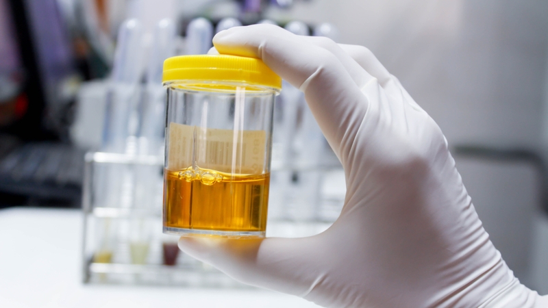 Chỉ số glucose trong nước tiểu khi mang thai cảnh báo gì về sức khỏe mẹ và bé? 1