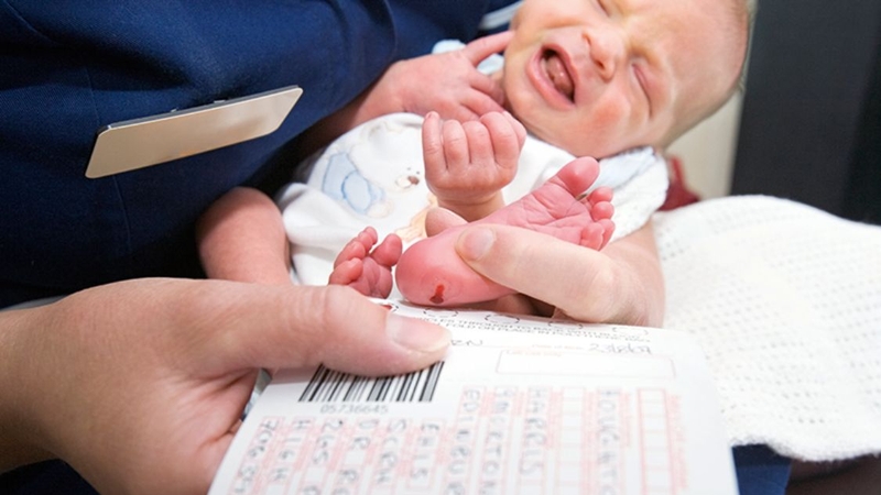 Chỉ số Hb bart's ở trẻ sơ sinh cao có sao không 1