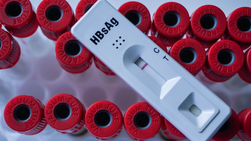 Kết quả xét nghiệm HBsAg âm tính thường cho thấy chưa nhiễm virus