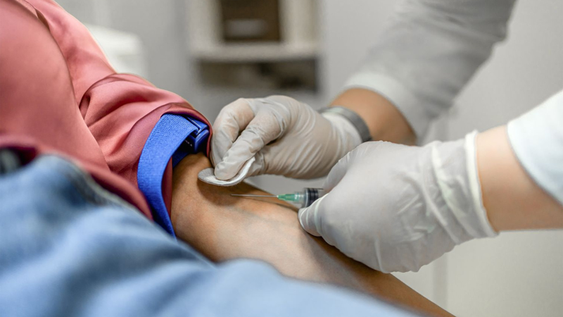 Chỉ số HbsAg là gì? Cách đọc kết quả xét nghiệm HBsAg 2