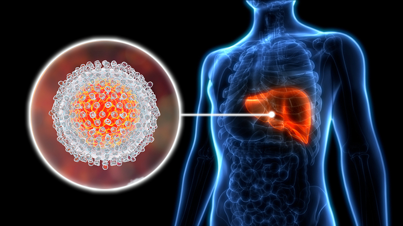 Chỉ số HbsAg là gì? Cách đọc kết quả xét nghiệm HBsAg 1