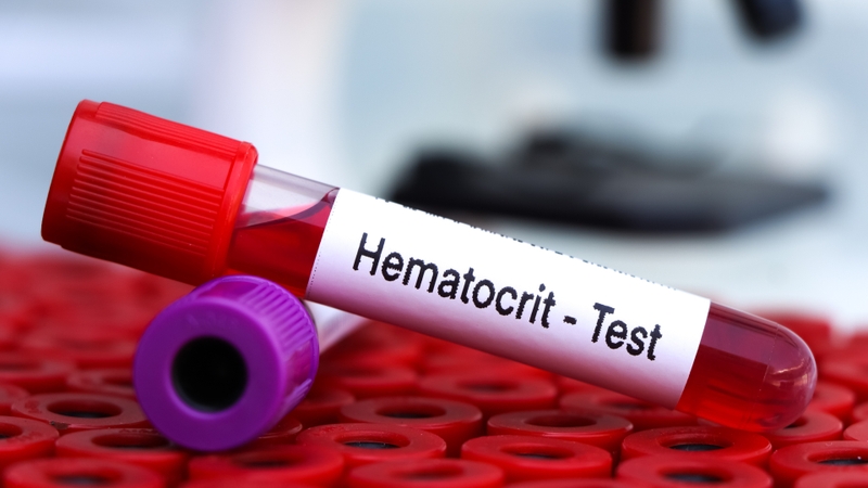 HCT trong xét nghiệm máu là gì? HCT phản ánh tỷ lệ phần trăm thể tích hồng cầu so với tổng thể tích máu