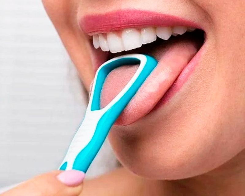 Chỉ số mảng bám Plaque index là gì?-4