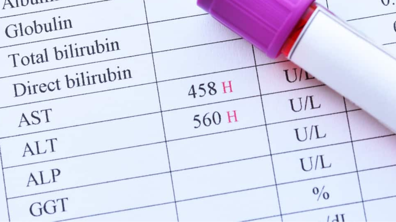 Chỉ số men gan cao là bao nhiêu? Nếu cao có đáng lo không? 2
