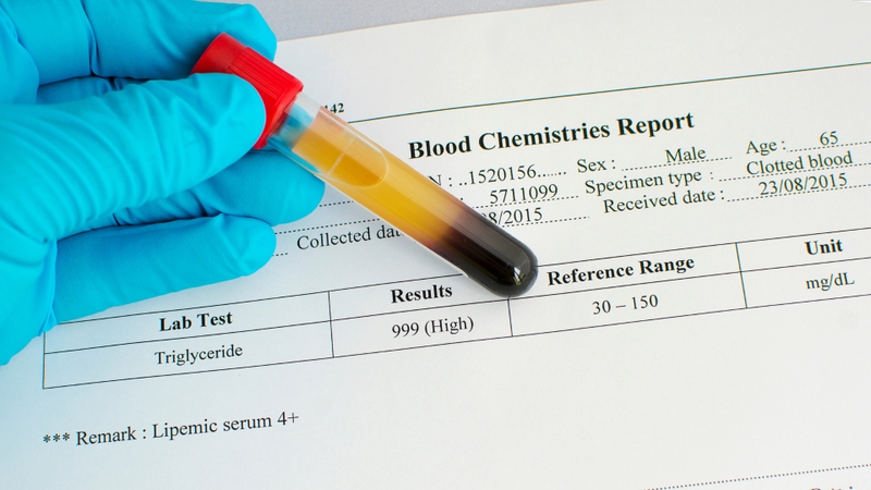 Chỉ số mỡ máu Triglyceride là gì và các biến chứng nguy hiểm 1