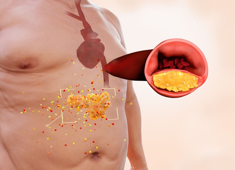 Chỉ số mỡ nội tạng là gì? Cách tính và những vấn đề sức khỏe liên quan cần biết 2