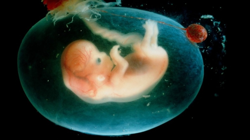 Chỉ số nước ối 60mm là bình thường hay đáng lo? Những điều mẹ bầu cần biết 1