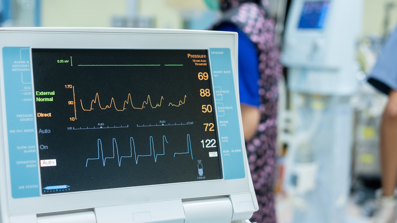 Cài đặt chỉ số PEEP là một quá trình điều chỉnh liên tục