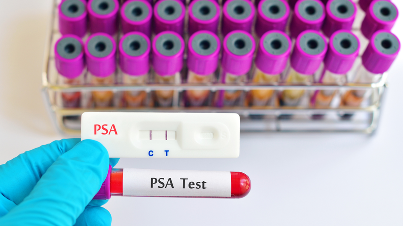 Chỉ số PSA là gì là thắc mắc phổ biến ở nhiều nam giới khi đi khám sức khỏe