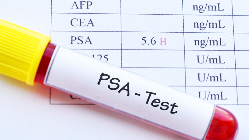 Kết quả xét nghiệm PSA giúp bác sĩ có thêm cơ sở để đưa ra hướng chẩn đoán và điều trị phù hợp