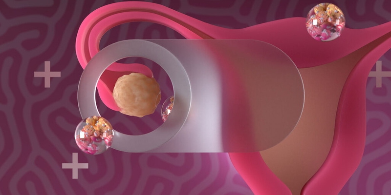 Chỉ số Roma có ý nghĩa như thế nào trong chẩn đoán bệnh ung thư buồng trứng? 1