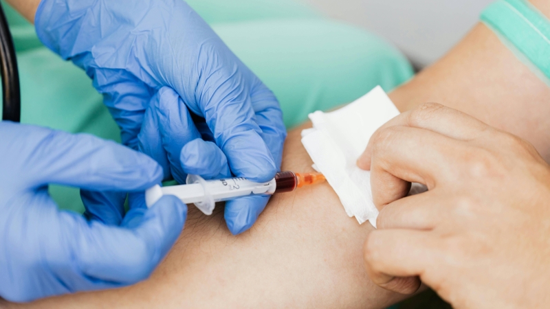 Xét nghiệm TSH giúp đánh giá chức năng tuyến giáp và trục nội tiết liên quan