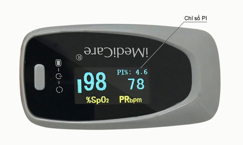 Chỉ số tưới máu PI là gì? Chỉ số tưới máu PI bình thường là bao nhiêu? 1