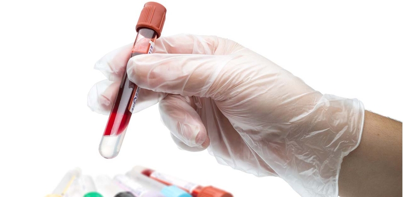 Chỉ số WBC trong xét nghiệm máu là gì?1