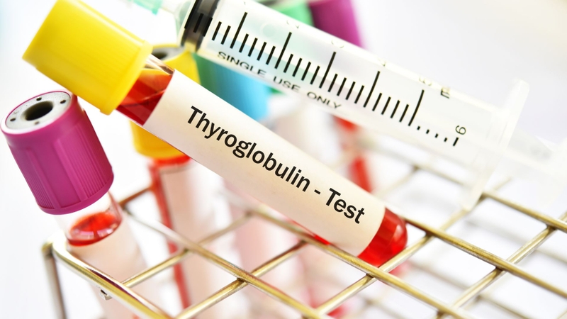 Anti-TPO và Thyroglobulin là hai chỉ số giúp phát hiện bệnh tuyến giáp tự miễn