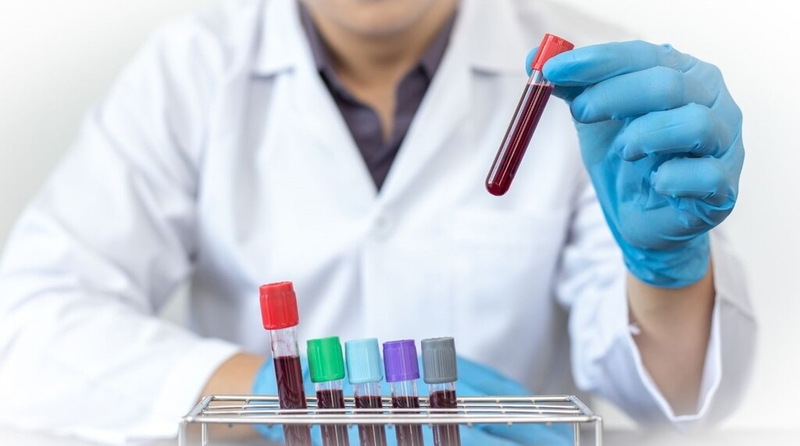 Chlamydia IgM là gì? Những điều cần biết về xét nghiệm Chlamydia IgM 2