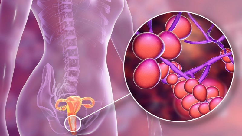 Chớ chủ quan khi bị đau rát vùng kín 2