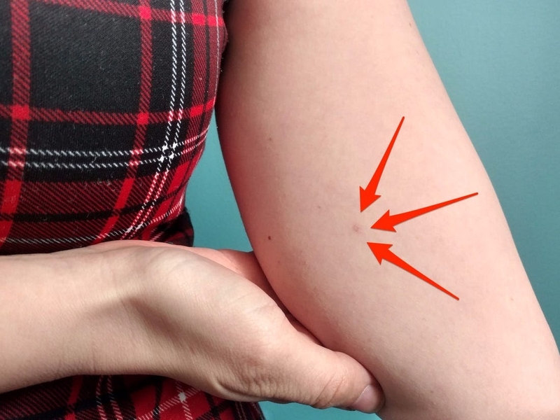 Cho con bú có thể cấy que tránh thai được không? 3