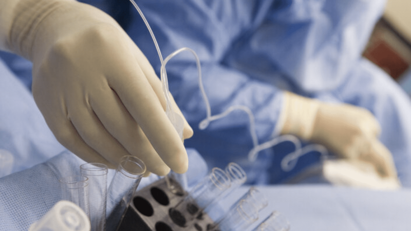 Chọc hút trứng: Quá trình, các biến chứng thường gặp và những điều cần lưu ý 3