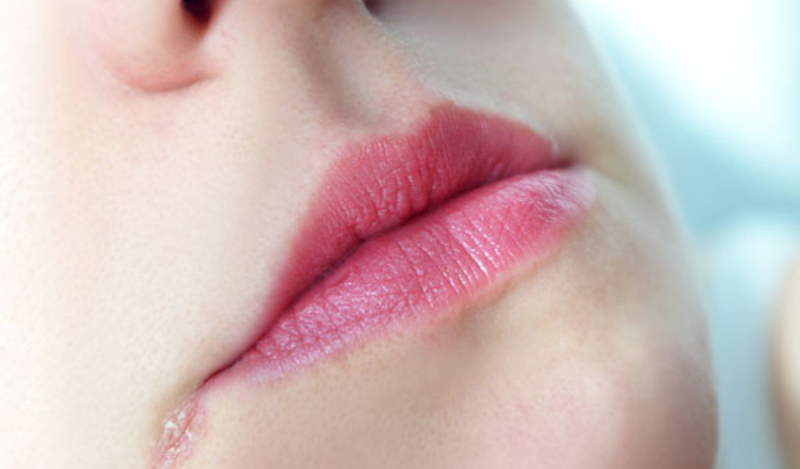 Con đường lây nhiễm chốc mép