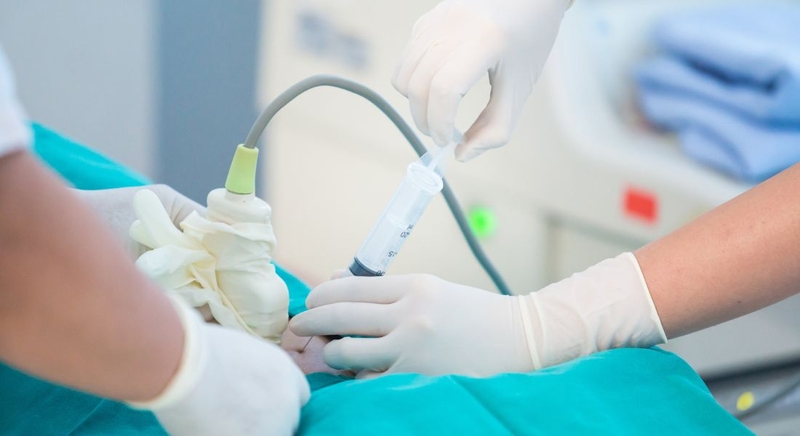 Chọc ối bao lâu có kết quả? Tìm hiểu chi tiết về chọc ối 3