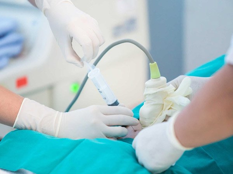 Chọc ối có đau không? Thời gian chọc ối phù hợp nhất các mẹ bầu nên biết 1