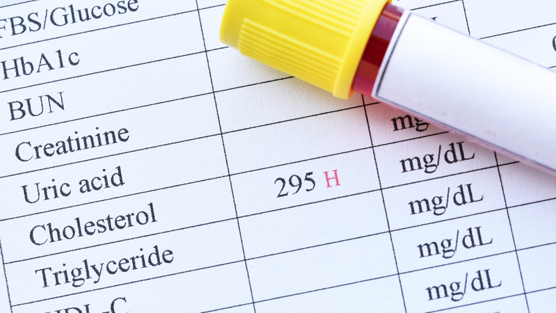 Cholesterol 101 có sao không? Triệu chứng tăng cholesterol