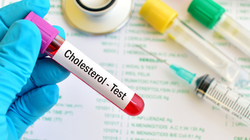 Cholesterol toàn phần là một chỉ số quan trọng trong xét nghiệm máu, giúp đánh giá nguy cơ mắc các bệnh lý tim mạch