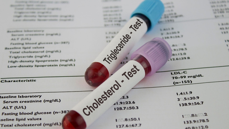 Cholesterol và Triglycerid khác nhau như thế nào?