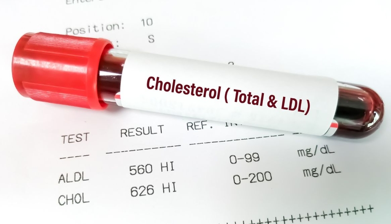 Cholesterol xấu là gì? Tác hại của cholesterol xấu và cách giảm cholesterol xấu 4
