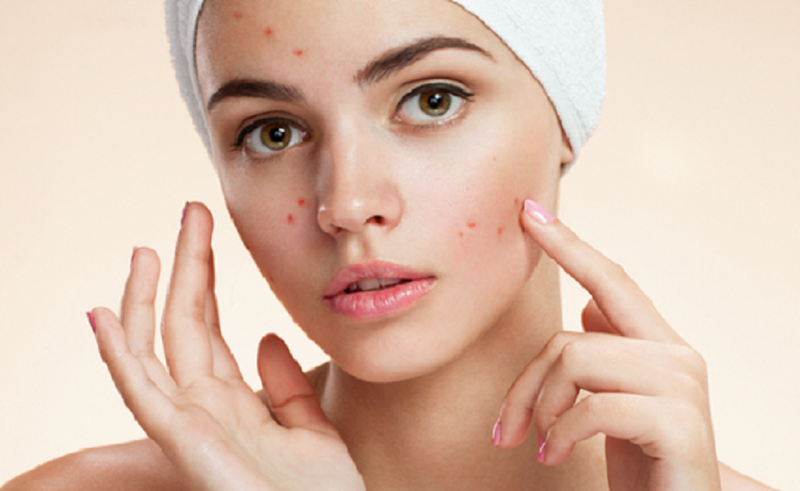 Chọn kem dưỡng ẩm cho da mặt nhạy cảm, không bị kích ứng 1