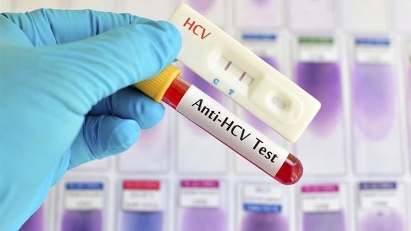 Chồng bị viêm gan C có lây sang vợ không? Hiểu rõ về sự lây truyền của viêm gan C 3