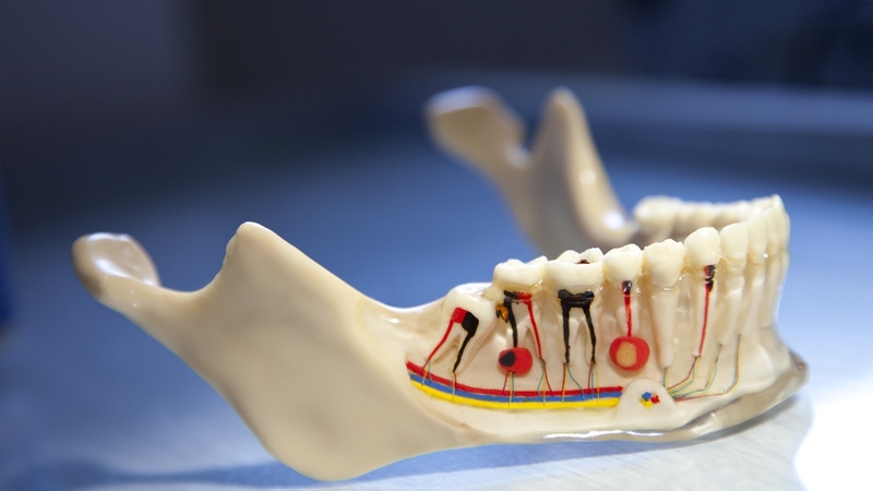 chop-rang-la-gi-vai-tro-cua-chop-rang-trong-suc-khoe-rang-mieng 3