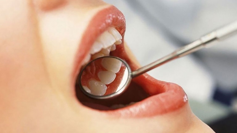 chop-rang-la-gi-vai-tro-cua-chop-rang-trong-suc-khoe-rang-mieng 4