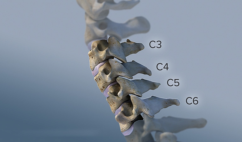 Chủ động phòng thoái hoá đốt sống cổ không bao giờ là sớm! 1