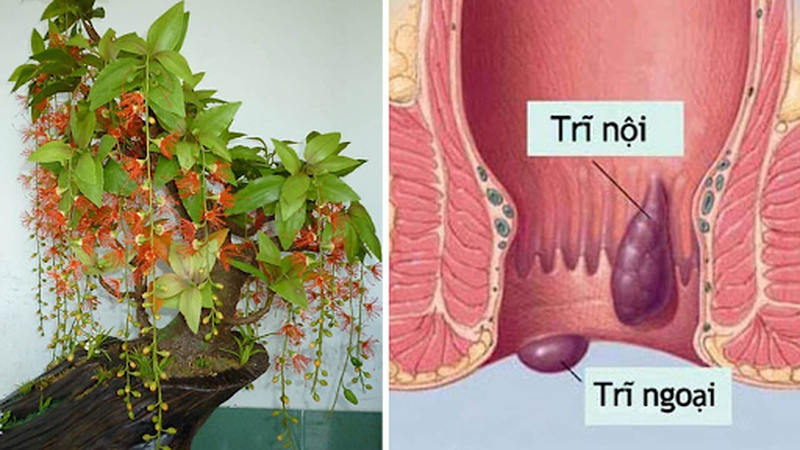 Phương pháp chữa bệnh trĩ bằng cây lộc vừng an toàn và hiệu quả 1