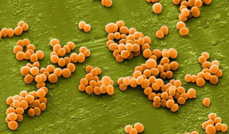 Nguyên nhân gây bệnh chốc lở