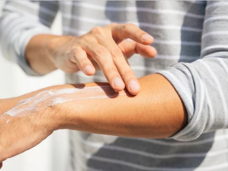 Chữa dị ứng thời tiết bằng lá lốt  4