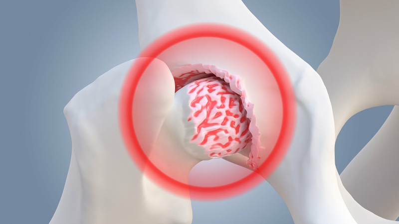 chữa hoại tử khớp háng bằng Diện Chẩn 1