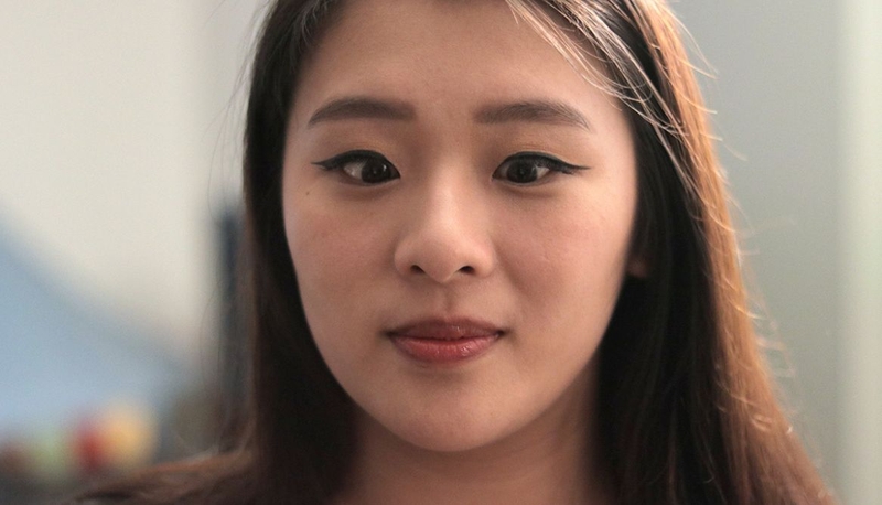 Chữa mắt lác ở người lớn khỏi hoàn toàn - Liệu có thể 3