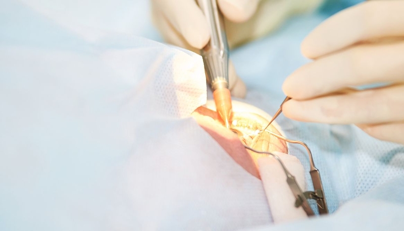 Chữa mắt lác ở người lớn khỏi hoàn toàn - Liệu có thể 2